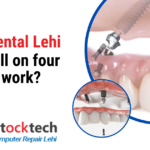 Stubbs Dental Lehi: How Do All-on-Four Implants Work?