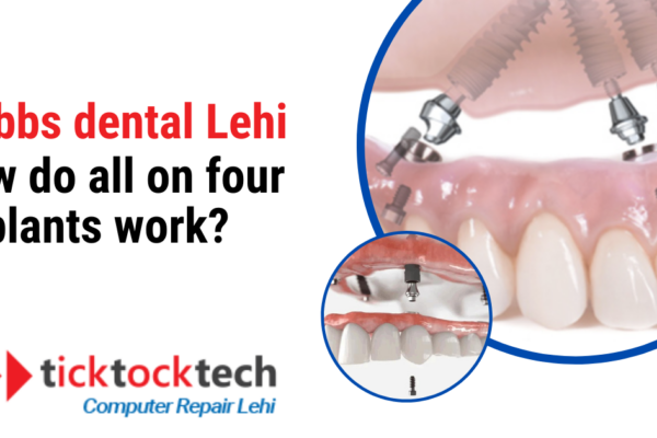 Stubbs Dental Lehi: How Do All-on-Four Implants Work?