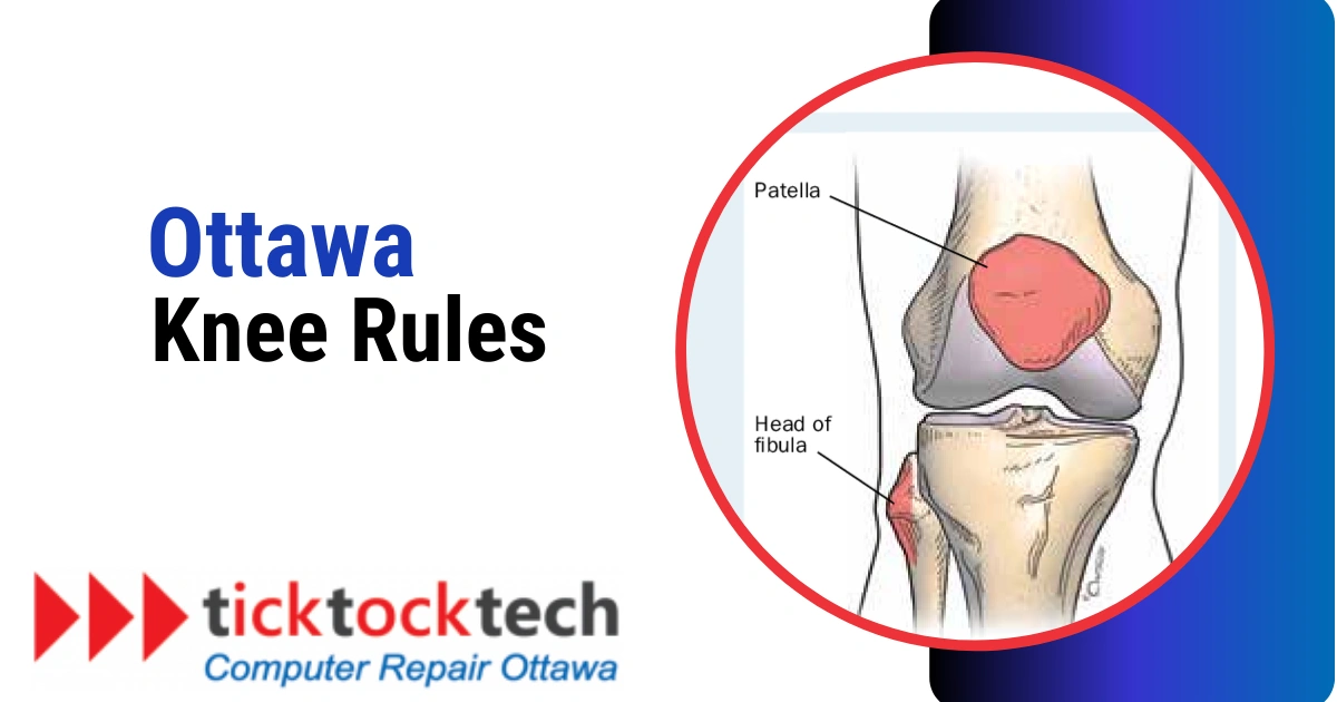 Ottawa Knee Rules. All You Need to Know